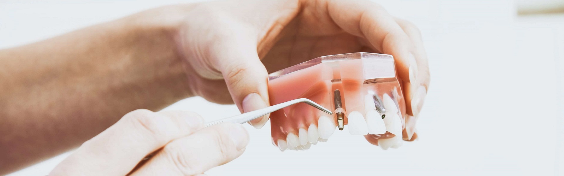 Rent a Car Airport Belgrade | Dental implants Belgrade